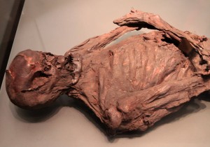 Gallagh Man; his remains were found in a bog in Galway County and is believed to have lived in the Early Iron Age (400-200 BC); he is now on display inside the National Museum of Ireland.
